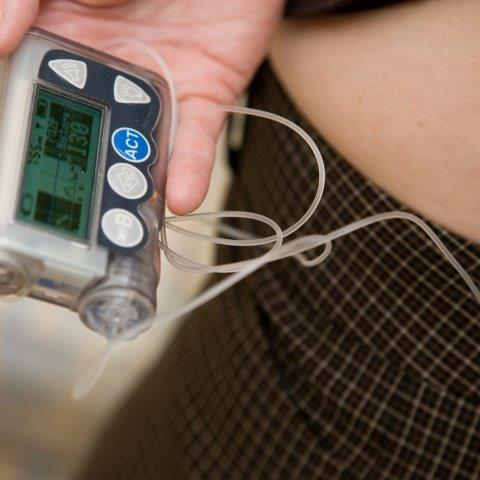 New to Devices? Insulin Pump and CGM Basics